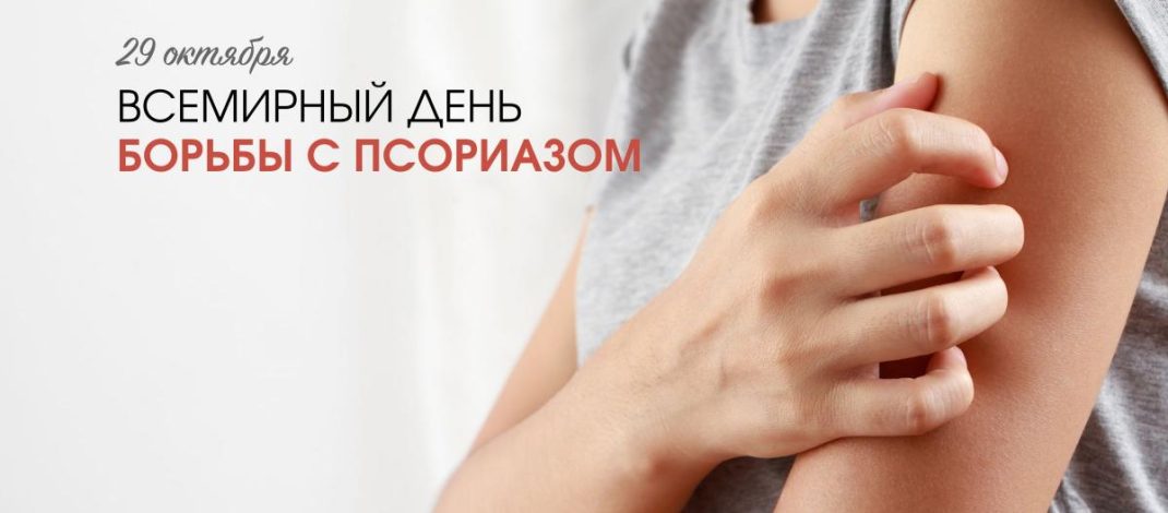 29 октября – Всемирный день борьбы с псориазом.